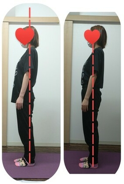 反り腰 ぽっこりお腹